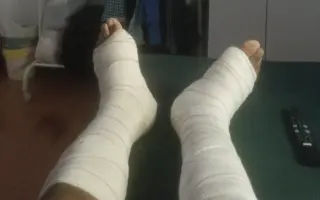 Ayúdame a conseguir mi bota ortopédica!