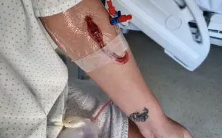 Vivo con dolor las 24 horas del día. Ayúdame a seguir luchando!