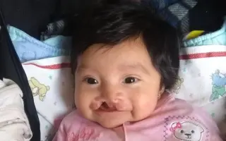 Ayuda para que mi hija vuelva a sonreír sin taparse la boca