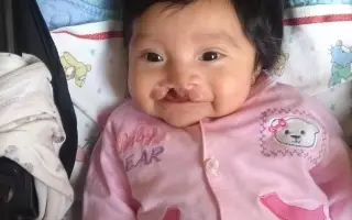 Ayuda para que mi hija vuelva a sonreír sin taparse la boca